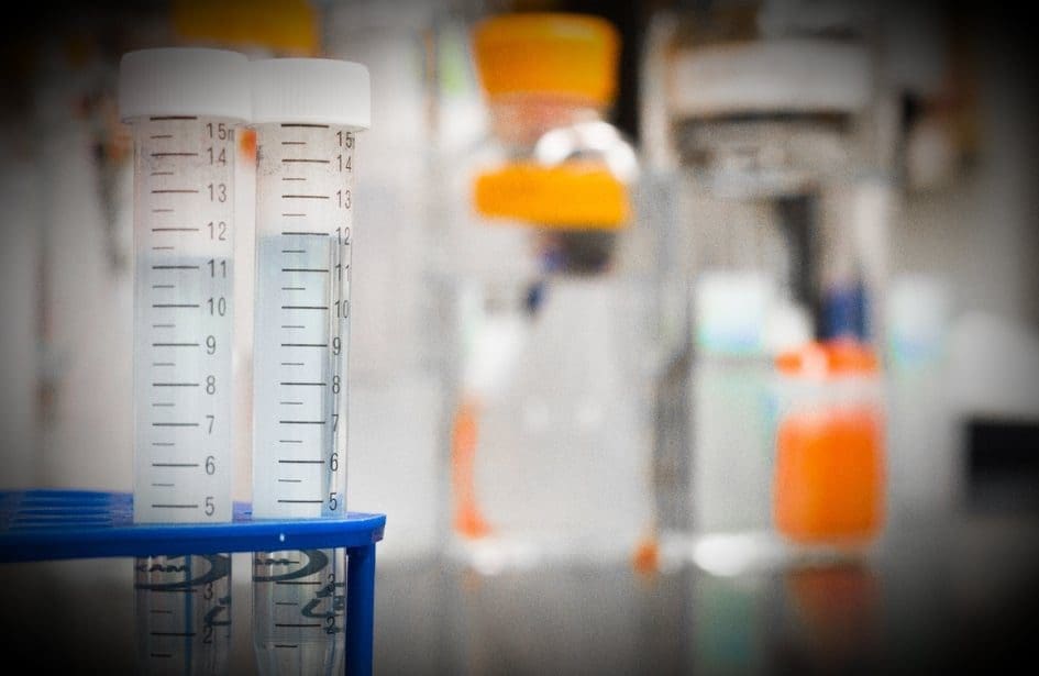 Do I Need A Urine Test (Urinalysis) Before Getting Treated For a UTI Through Telemedicine?