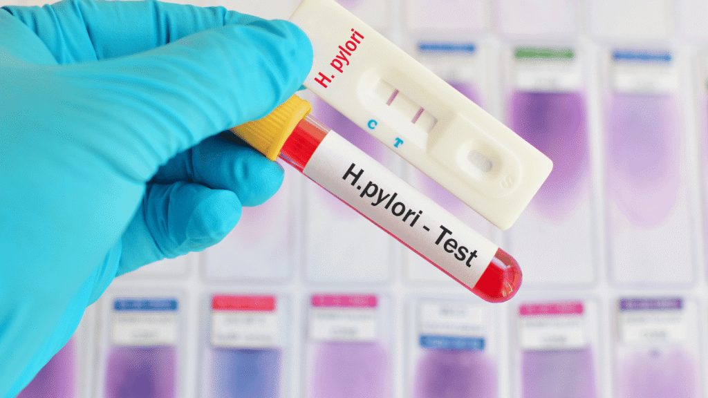 How Do I Get Tested for H. Pylori?