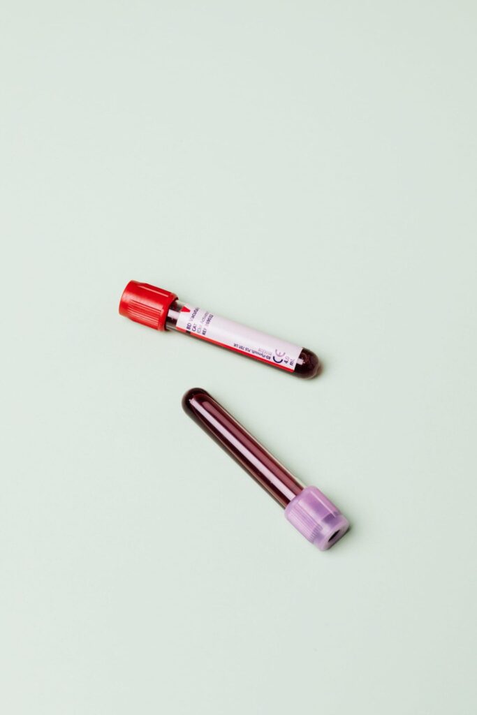 What Are Thyroid Function Tests?